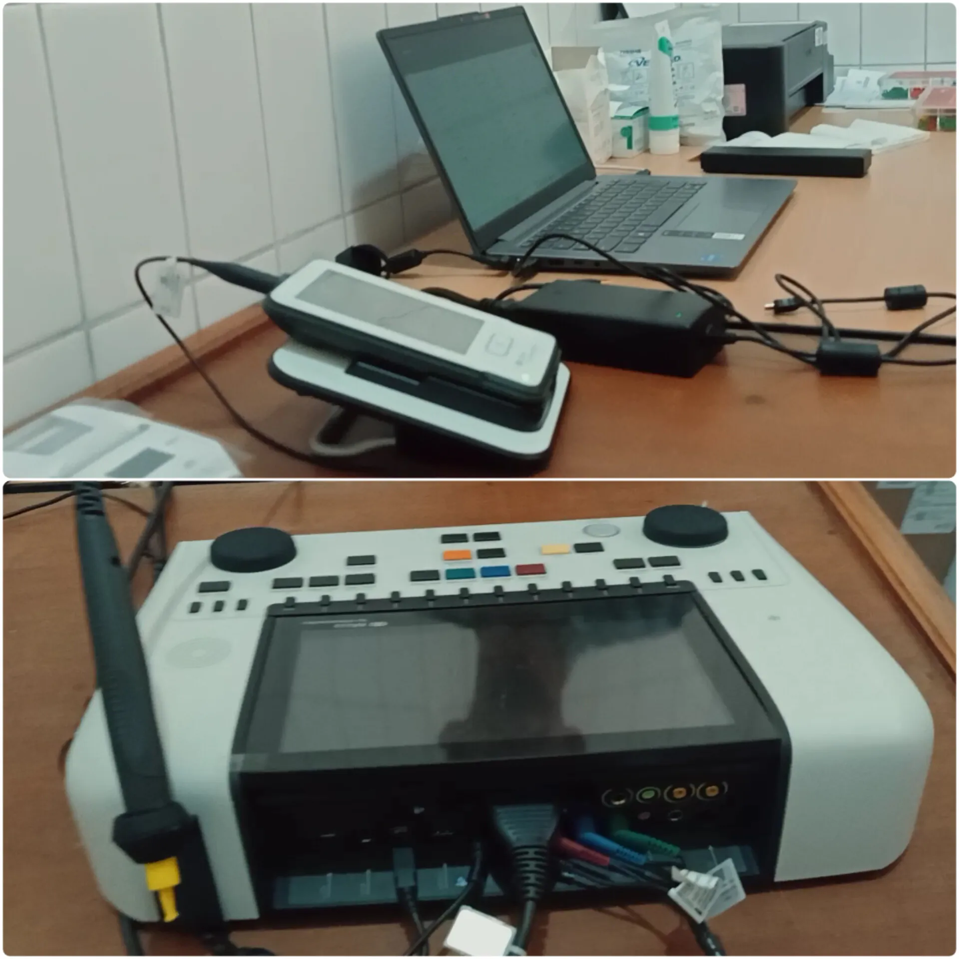 Untuk Mendeteksi Dini Gangguan Pendengaran, RSUD Sayidiman Hadirkan Layanan OAE & Audiometri